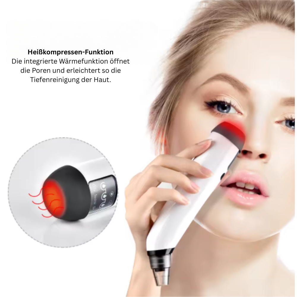 ClearSkin Pro – Elektrischer Mitesser-Entferner mit Wärmefunktion MySalvora